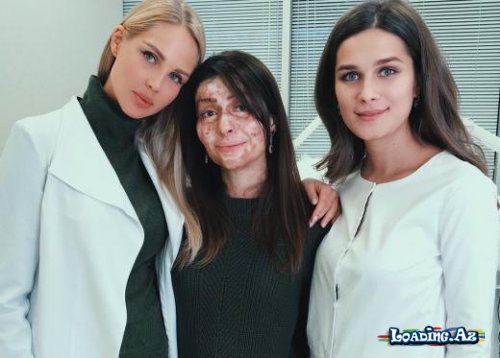 Tanınmış aktrisa Ülviyyə Əliyeva ərə gedirÜzü yanmış azərbaycanlı qıza rusiyalı futbolçunun həyat yoldaşından dəstək – FOTO - Sun.Az
