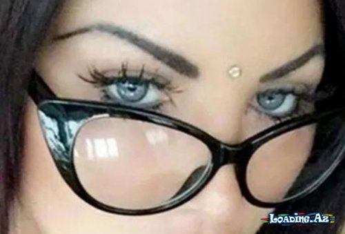 Model gözəllik uğrunda gözlərini itirdi - FOTO - Sun.Az