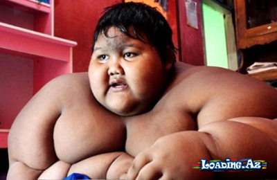 Dünyanın ən gombul uşağı 100 kiloqram arıqladı - FOTO