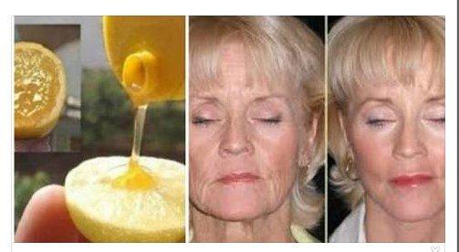 Limon+bal! 10 yaş gəncləşin! - Sun.Az