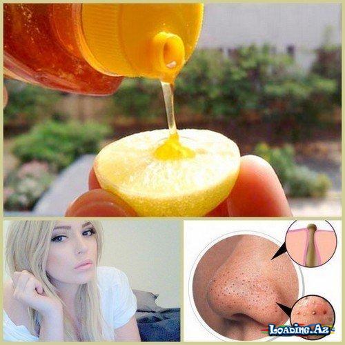 Limon və balla qara nöqtələrə və sızanaqlara son - Sun.Az