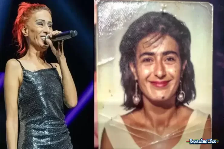 Yıldız Tilbedən illər sonra ETİRAF: “Uşaqlıqda qulağımı itirdim” - Sun.Az